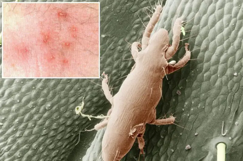 Dangerous Bugs in Kansas